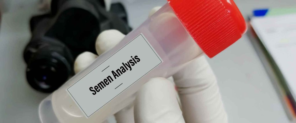 analisis sperma dan tes halo
